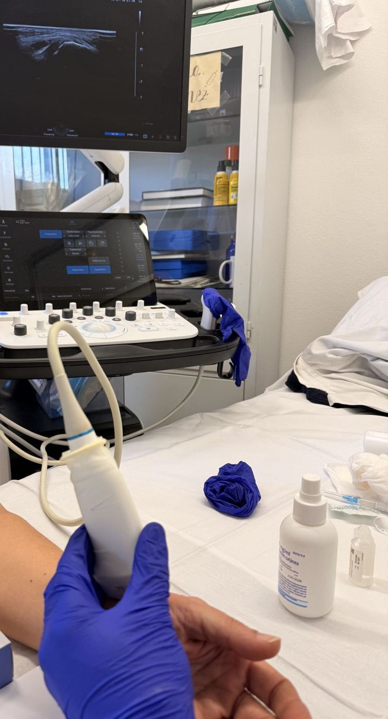 Sonda de ecografía sobre el brazo de un paciente en Barcelona Cryo Center